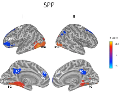 Figure  10  (sopra)  e  Figura  11  (sotto).  Le  serie  temporali  medie  estratte  separatamente  dal  centro  delle  regioni  d’interesse, che corrispondono al Giro Fusiforme sinistro (FG) (sopra) e al Giro Fusiforme destro (sotto) nei pazienti   con Fo