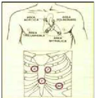 Figura 2.3 Proiezione dei punti di auscultazione delle valvole cardiache 