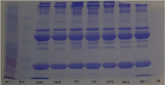 Figura 4. 5  SDS-PAGE di alcuni campioni di plasma di piccione