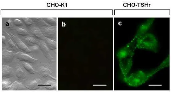 Fig.  13  Immune-localization  by  fluorescent  microscopy  of  anti-TSH  receptor  antibodies  in 
