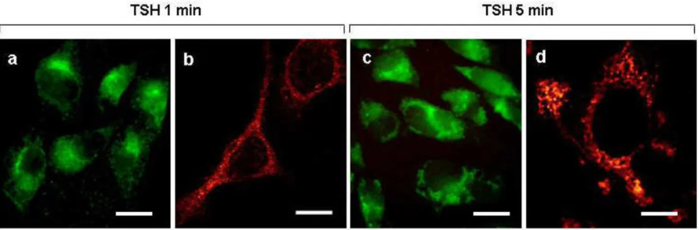 Fig.  14  Immune-localization  by  fluorescent  microscopy  of  anti-TSH  receptor  antibodies  in 