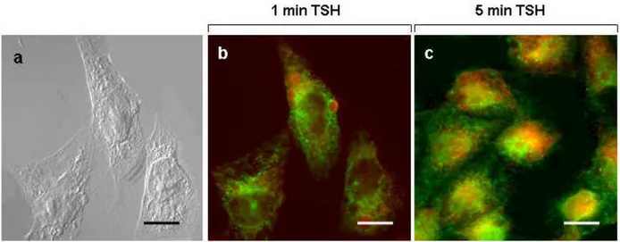 Fig.  15  Immune-localization  by  fluorescent  microscopy  of  anti-TSH  receptor  antibodies  in  CHO-