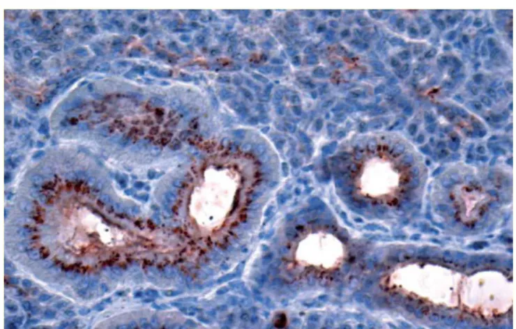 Figura 5. Immunoistochimica con anticorpo primario 2G11 