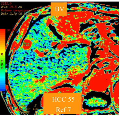 Figura 3b Figura 3b Figura 3c BV HCC 55Ref 7 HCC 8.3Ref 10.6HAF