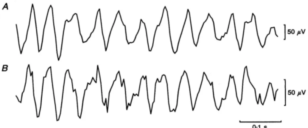 Fig. 9 Le due figure mostrano registrazioni simultanee di onde lente corticali, mettendo in 