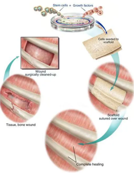 Figure 5: Scaffold-guided Tissue Regeneration 