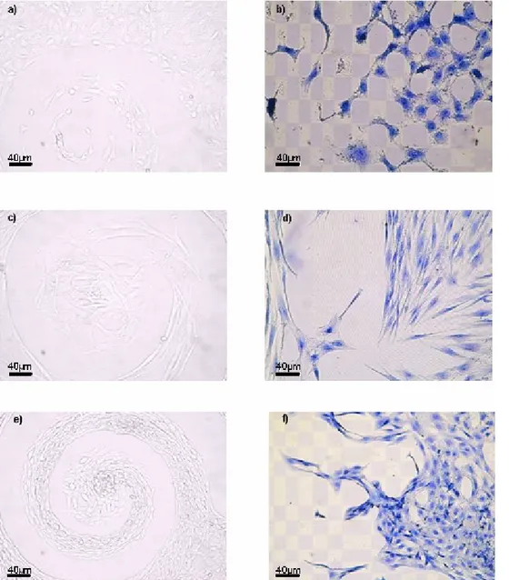 Fig. 1. Light microscope images. HCAEC seeded on negative spiral a) and  squared surfaces b); human dermal fibroblasts seeded on negative spiral  c)  and  squared  surfaces  d);  NIH3T3  seeded  on  negative  spiral  e)  and  squared surfaces f)