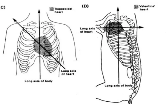 Figura  5.  Rappresentazione  schematica  comparativa:  differenze  di  relazione  tra  la  siluette  cardiaca  e  la  circostante gabbia toracica nell'uomo (C) e nel suino (D)
