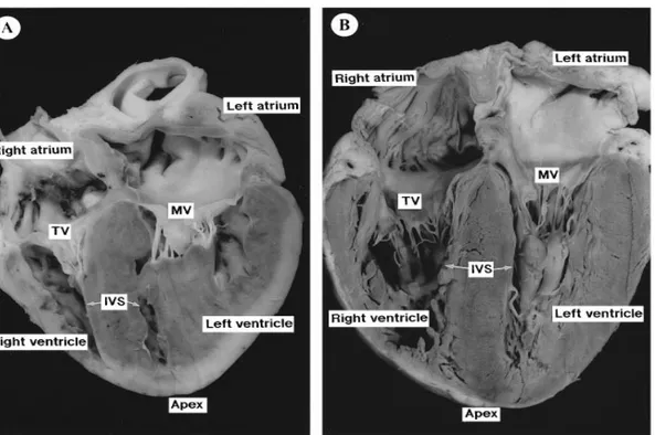 Figura  n.9.  Sezione  delle  quattro  camere  cardiache  del  cuore  di  suino  (A)  e  di  uomo  (B)