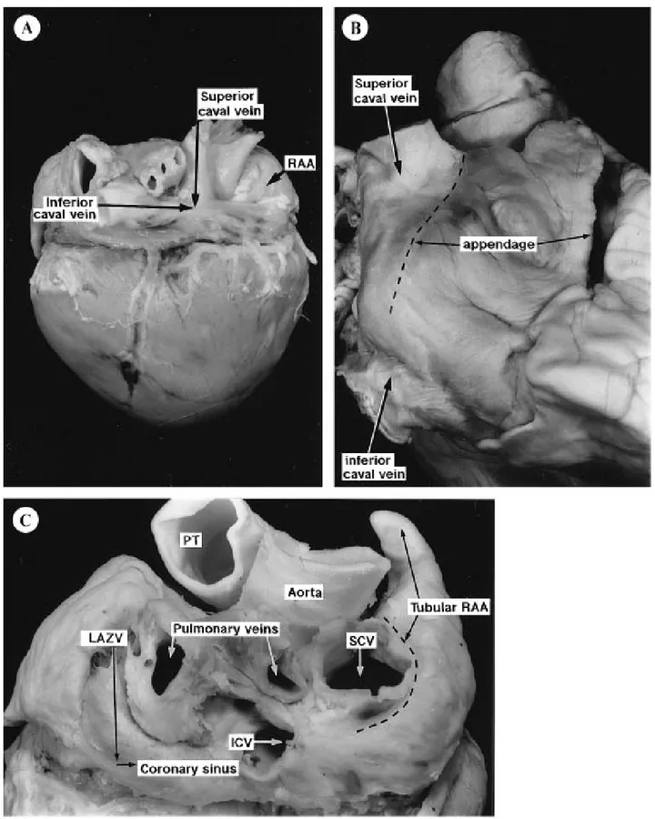 Figura n.10. Aspetto esterno dell'atrio destro di suino (A), di uomo (B) e particolare delle componenti venose  del cuore di suino (C)