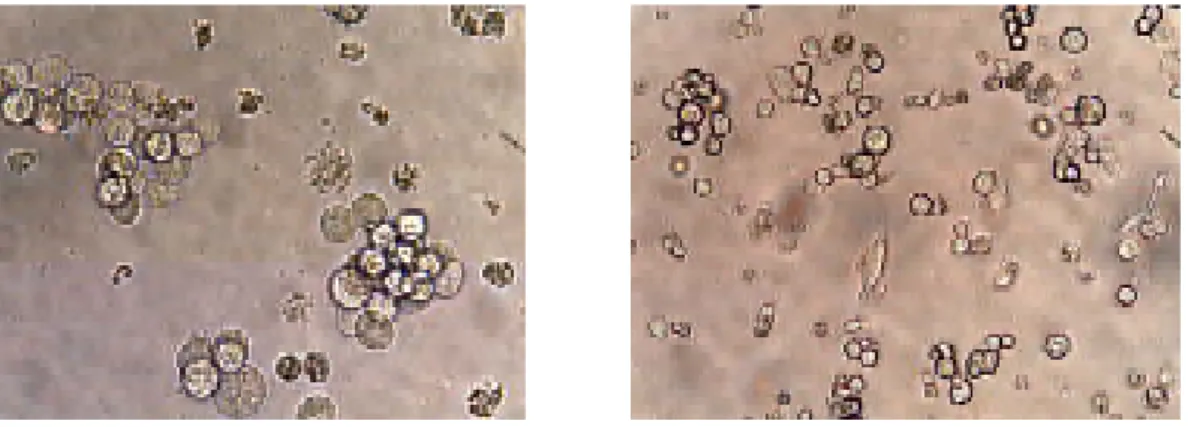 Fig 3:  Meg-01 control and Meg-01 after treatment with 10-7 M β β β β-TPA