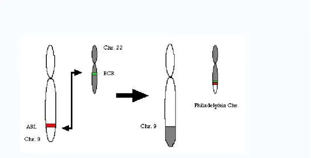 Figura 13 -Cromosoma Philadelphia è designato Ph (o Ph') e la traslocazione cromosomica è denominata  t (9; 22) (q34.1; q11.2)- 