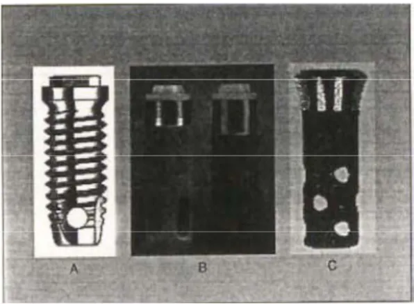 Figura 1 - impianto endosseo: A=filettato, B=cilindrico, C=forato 