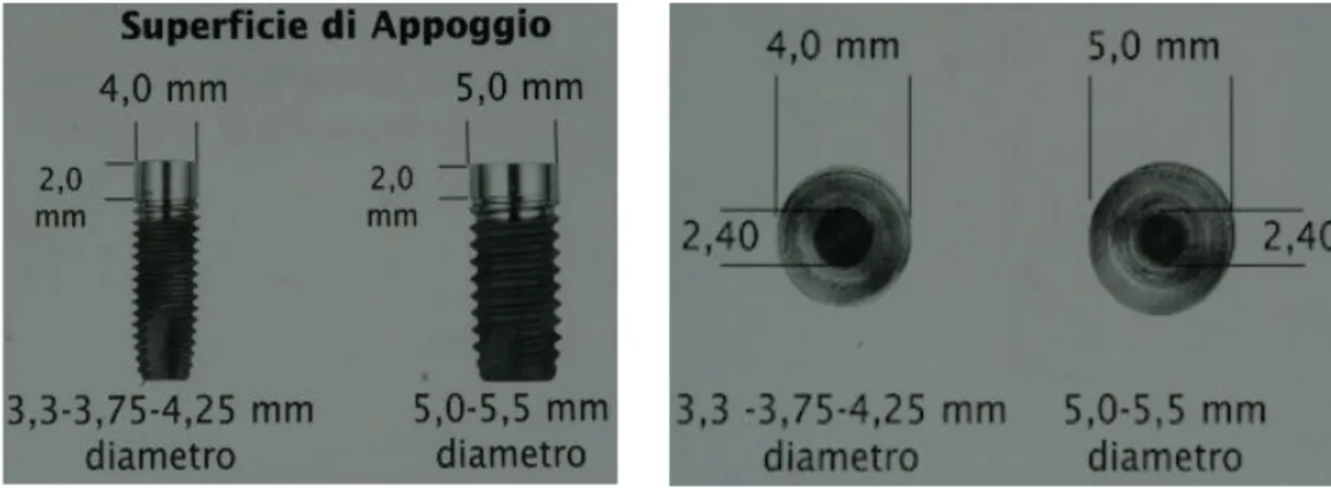 Figura 3 - Impianto Isomed a vite cilindrica 