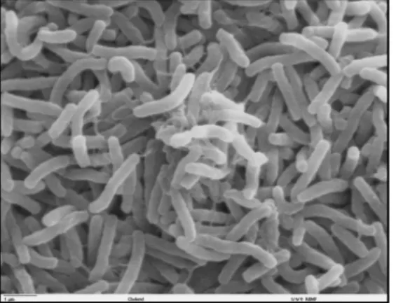 Fig.	
  7	
  Vibrio	
  cholerae