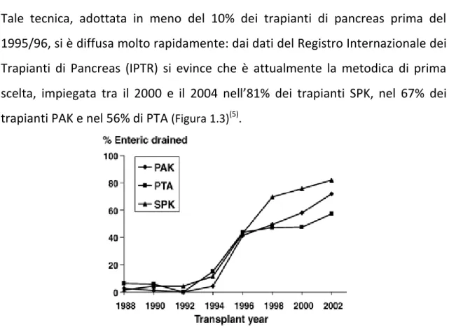 Figura 1.3: Percentuale di trapianti di pancreas con drenaggio enterico, eseguiti 