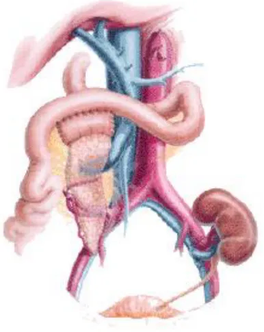 Figura 1.4: Trapianto di pancreas con drenaggio portale enterico. 