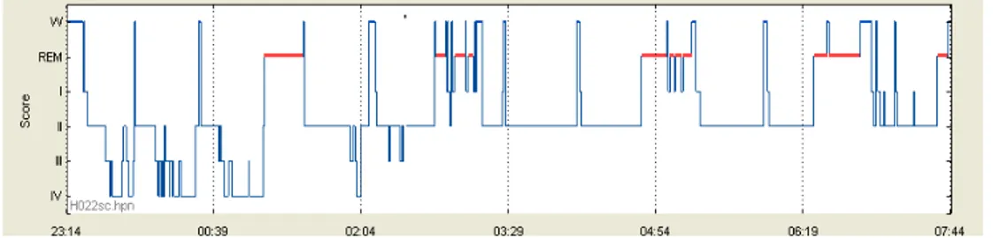 Fig. 2: Hypnogram of a typical night recorded in a young subject. 