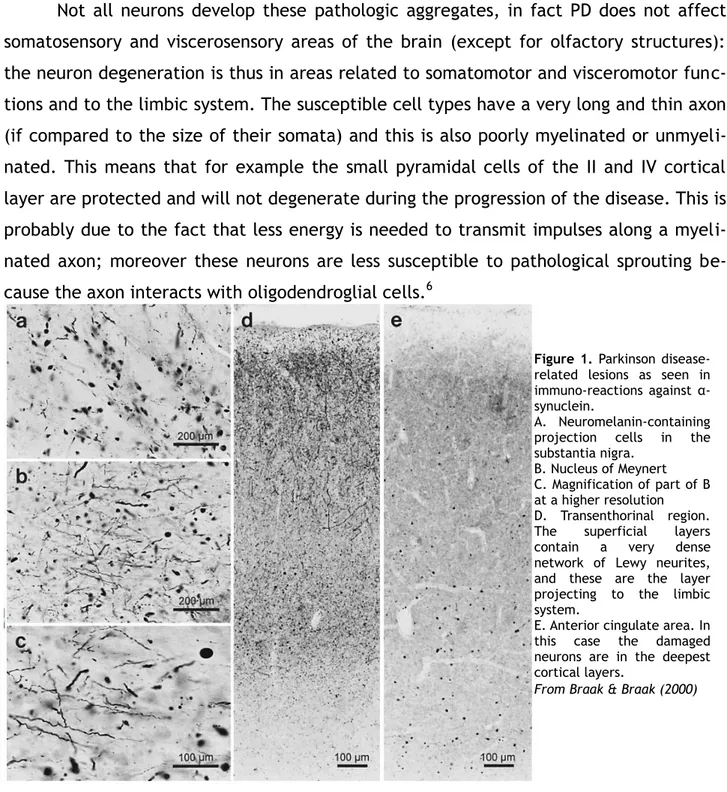 Figure  1.  Parkinson  disease- disease-related  lesions  as  seen  in  immuno-reactions  against   α-synuclein