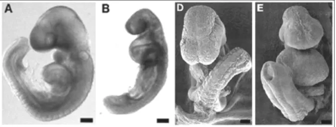 Fig. 1.5: In  A e D, embrioni di topo “wild type” a 9 giorni di gestazione,  in visione laterale (A)  e 