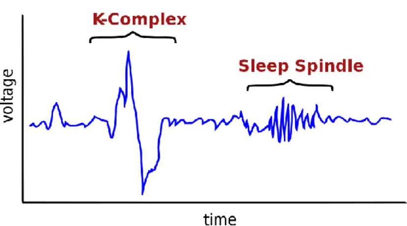 Figura 2 EEG con complessi K e fusi caratteristici della seconda fase del sonno NREM.  (https://it.wikipedia.org/wiki/Complessi_K n.d.) 