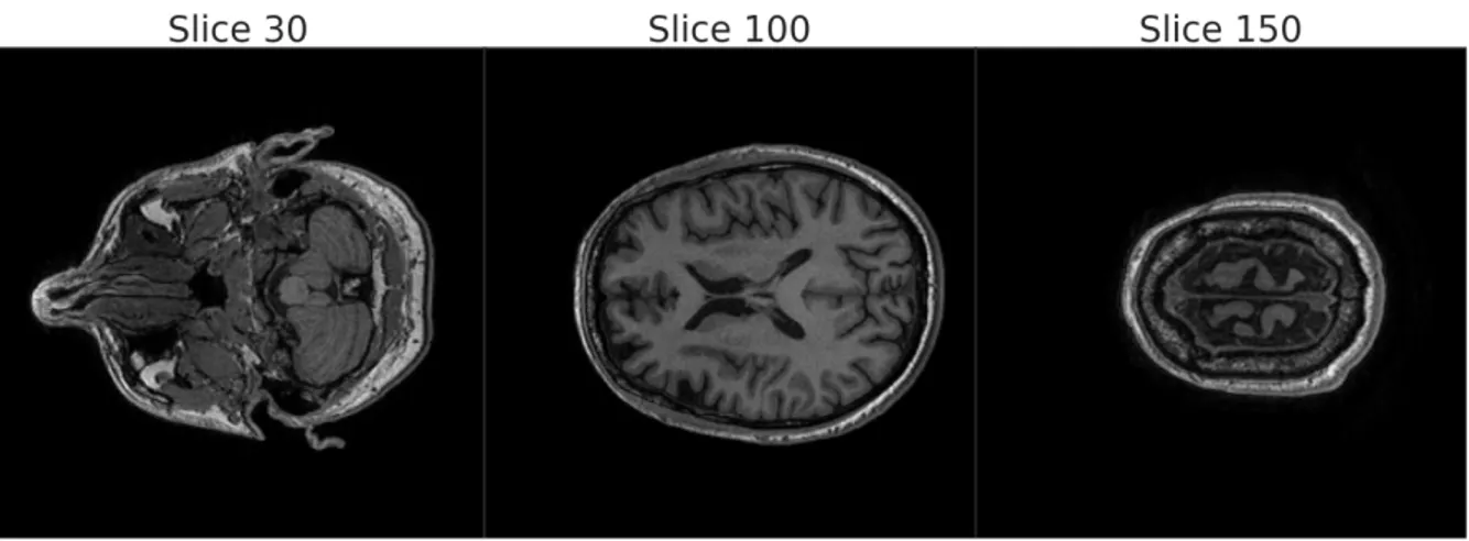 Figure 3.6: HR 256 × 256 original image at three different stages of depth: (left) slice 30 where still a lot of information about the brain is hidden, (center) slice 100 which is a central slice where most of the information is stored, (right) slice 150 w