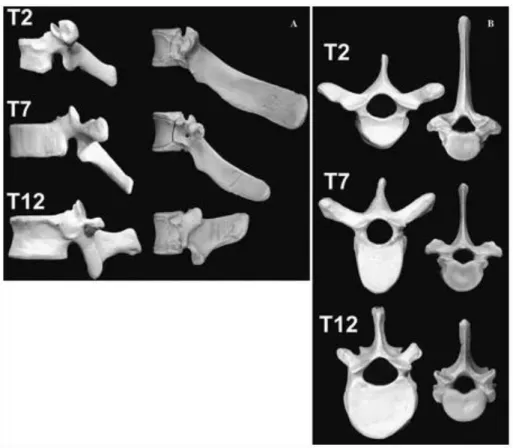 Figure 1.2.i  Representative dried human (left) and porcine (right) vertebrae from the 
