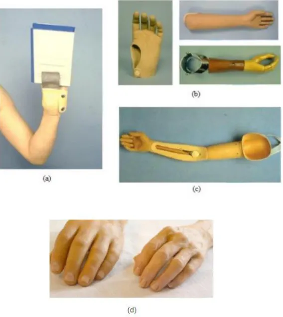 Fig. 7 Protesi lavorativa (a), esoscheletriche (b), endoscheletrica (c), in silicone (d)