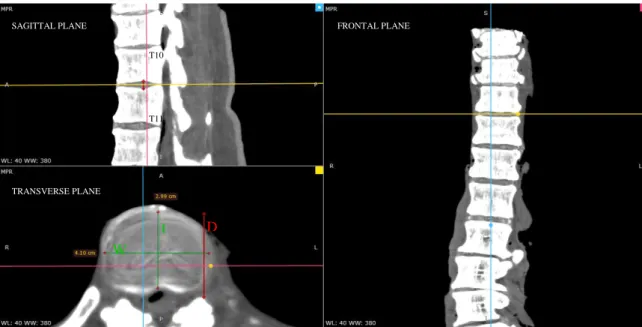 Figure 2.14– RadiAnt DICOM viewer interface. In the sagittal planele yellow line marks the midplane of 