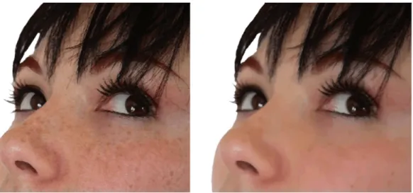 Figura 3.7: Applicazione di un banco di filtri con lo scopo di eliminare le imperfezioni facciali.