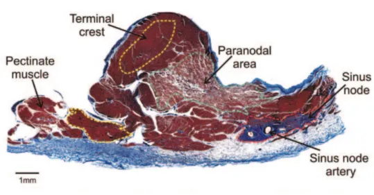Figure 1.1: Histological section of the SAN [12].