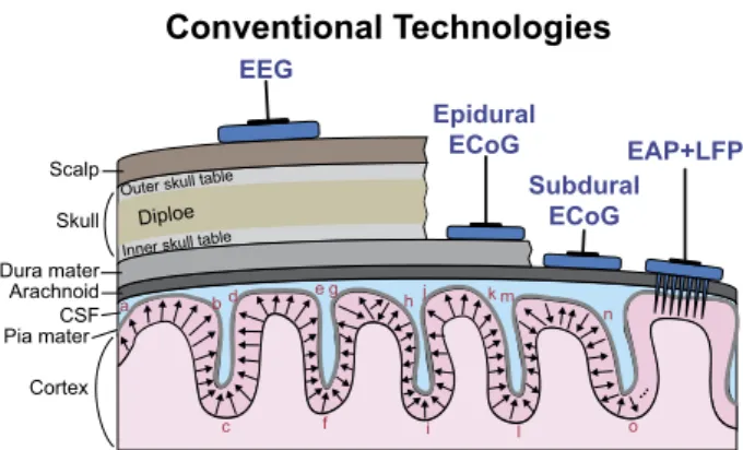 Figura 1.3: Metodi di elettrofisiologia convenzionali tra cui EEG, ECoG epidurale e subdurale e  registrazione LFP con microelettrodi penetranti 