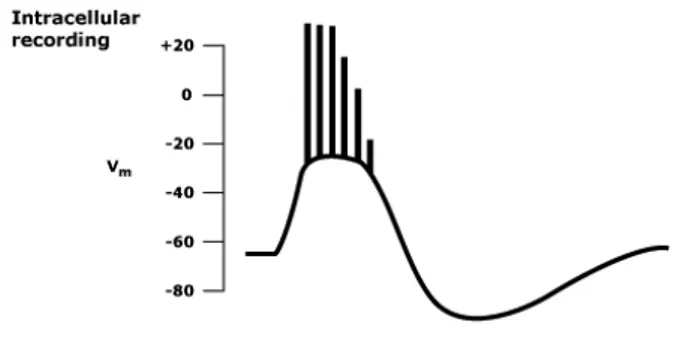 Figura 4 - Onda di depolarizzazione parossistica (OPD) 