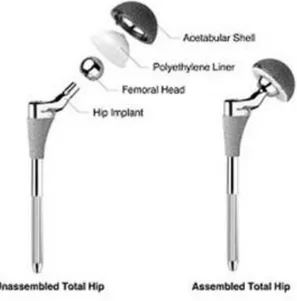 Fig 2: the components of a hip prosthesis 