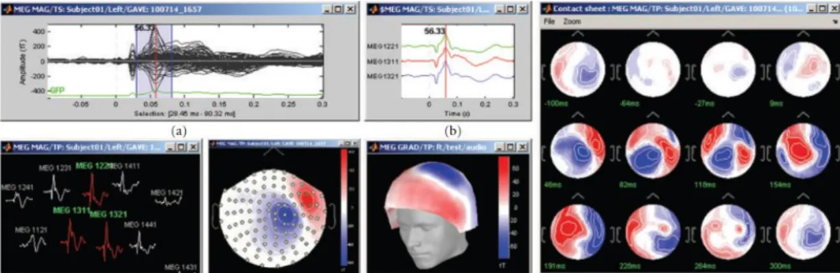 Figura 14: Soluzioni per visualizzare le registrazioni MEG/EEG [13]. 