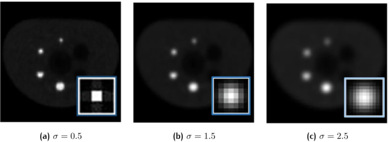 Figure 2.5: Application of gaussian lter to PET phantom image with σ = 0.5 (a), σ = 1.5 (b)