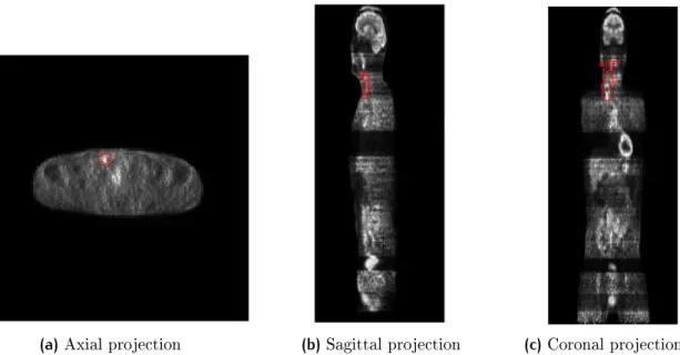 Figure 2.11: Slice segmentation of PET image in three dierent projections: axial(a), sagittal(b)