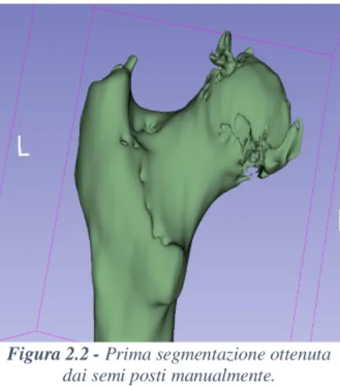 Figura 2.2 - Prima segmentazione ottenuta 