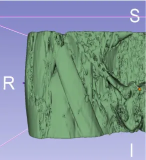 Figura 2.8 – Visualizzazione dei segmenti di  femore e 