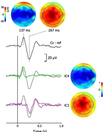 Figura 2.13 – Blind source separation di un ERP usando l'ICA. Gli ERP somatosensoriali sono stati elicitati tramite la 