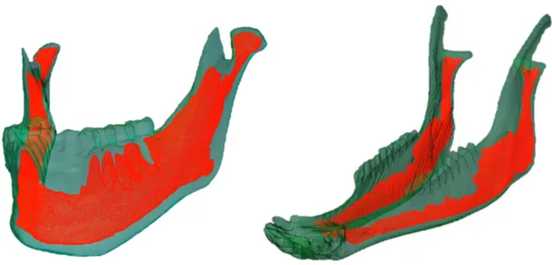Figure 2.2 – Segmented bone geometry of (a) human mandible and (b) sheep mandible, where cortical  bone is shown in green and trabecular bone in red