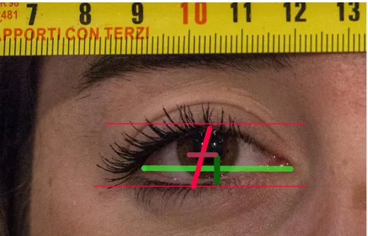 Figura  2-F:  differenza  di  posizione  tra  il  centro  oculare  calcolato  a  partire  dagli  angoli  (verde)  o  dai  bordi superiore e inferiore