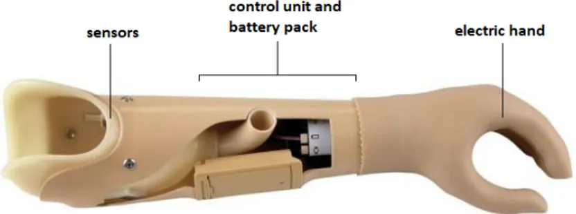 Figure 1.1: Myoelectric prosthesis