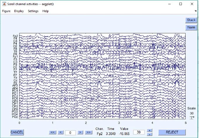 Figura 3.1.8: Visualizzazione nel tempo dei segnali importati EEG in EEGLAB 