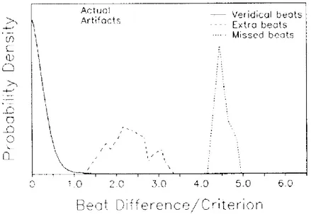 Figura  3.2.7:  Distribuzione  di  probabilità  delle  differenze  tra  IBI  adiacenti  relativi  a  battiti  veridici  (linea  continua),  e  relativi a IBI di artefatto (battiti spuri linea tratteggiata, battiti omessi linea punteggiata)