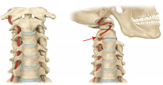 Figura 2: arteria vertebro-basilare 