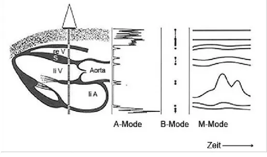 Figura 1.5 rappresentazione ecocardiografica in A-mode, B-mode, M-mode 