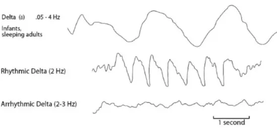 Figura 1.6 Esempi di onde delta 