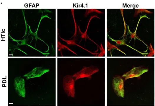 Figura  19a  Analisi  Western  blot  e  quantificazione  dell'espressione  della 