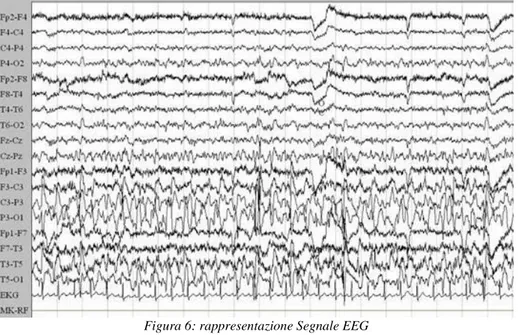 Figura 7: ritmi EEG 